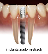implantant zob